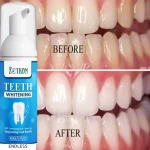 Teeth Whitening Foam