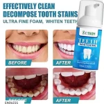Teeth Whitening Foam